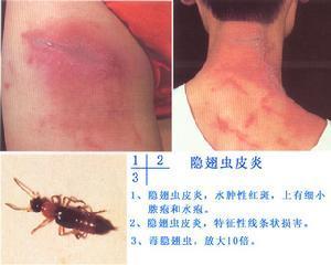 047f5b43c122c9ba1d4869f8d241d546_hd.jpg 047f5b43c122c9ba1d4869f8d241d546_hd.jpg